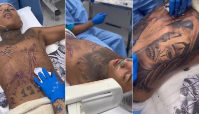 anestesia geral tatuagem.jpg