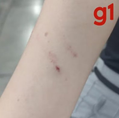 agressao ufmt.jpg