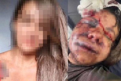 ROSTO DESFIGURADO - EX JOGADOR - SOCOS.jpg